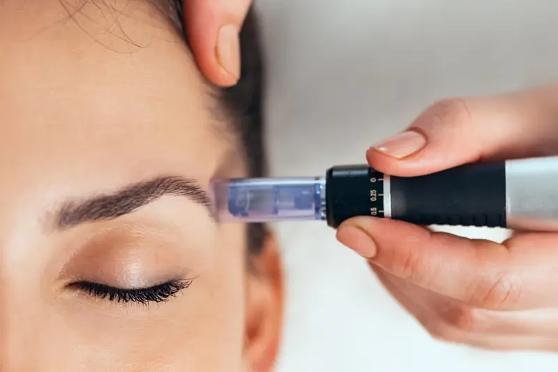 microneedling vs botox